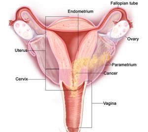 col-uterino