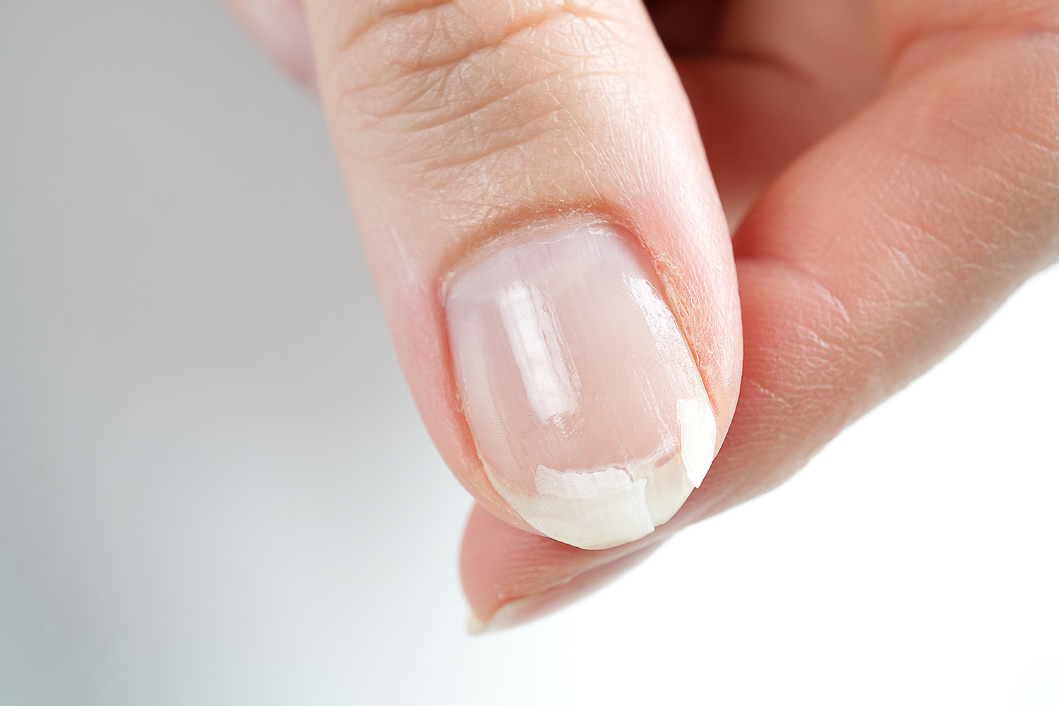 Por que se rompen las uñas?: motivos, tratamientos y prevención